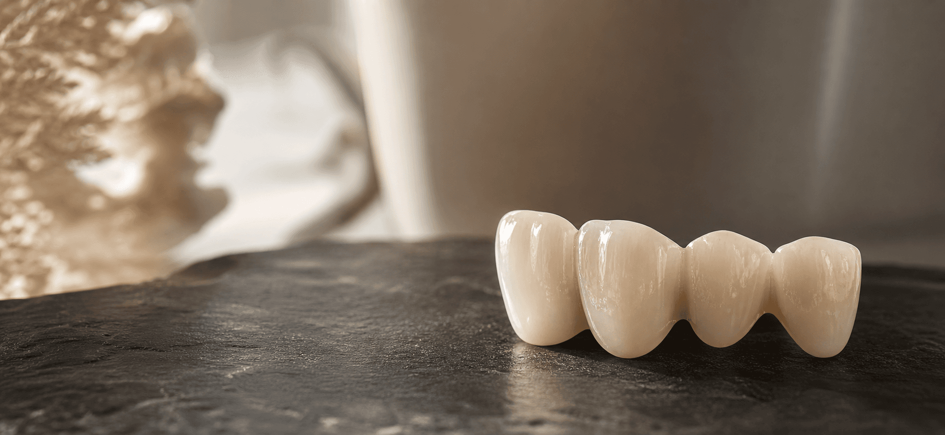 Model of a dental bridge spanning a gap between two supporting teeth