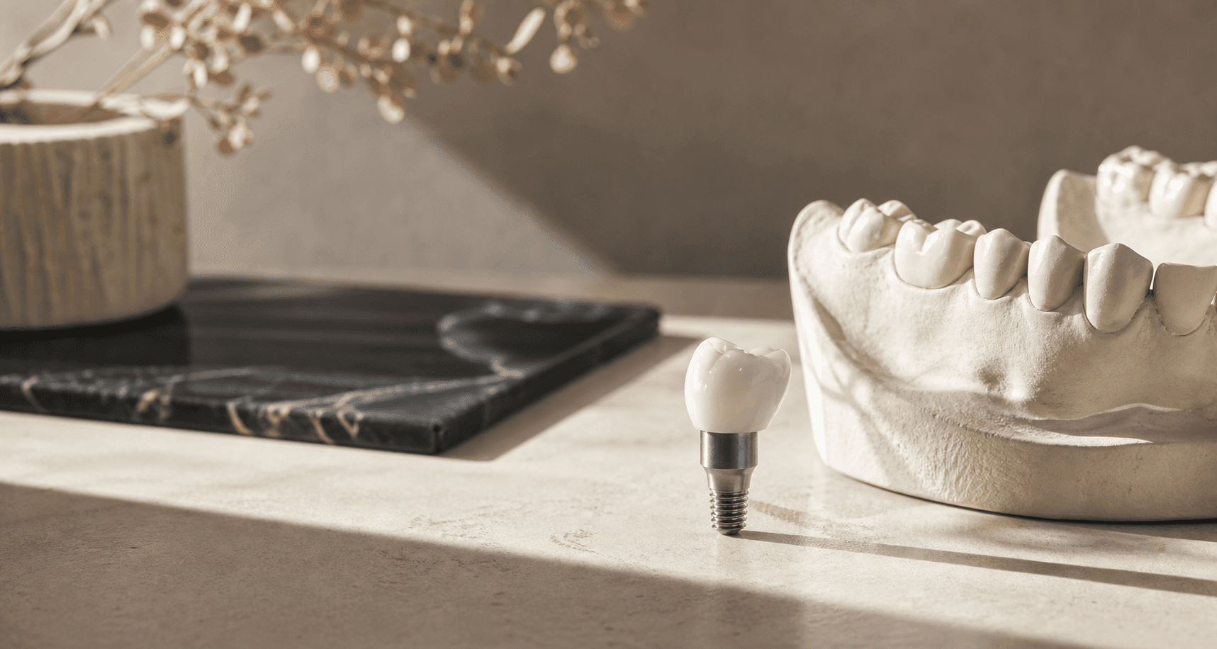 Model of a dental implant crown restoration used during a consultation at Midland Dental Center